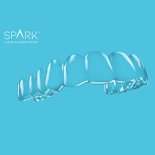 Olsen Orthodontics -Spark Clear Aligners in Rawling & Worland WY