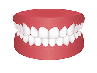 Orthodontic issues - Early Treatment in Lander & Riverton WY - Olsen Orthodontics